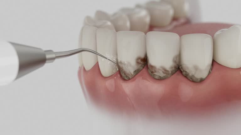 Reliable Dental contractor in Storrs, CT by Dentist Open Now
